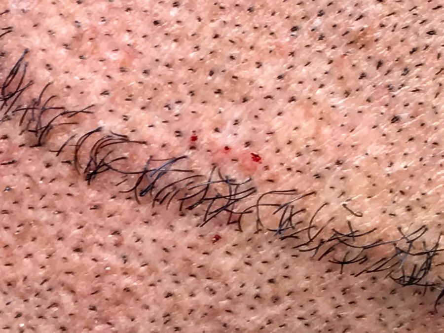 © Jeff Mermelstein, de la série Hardened, 2017.